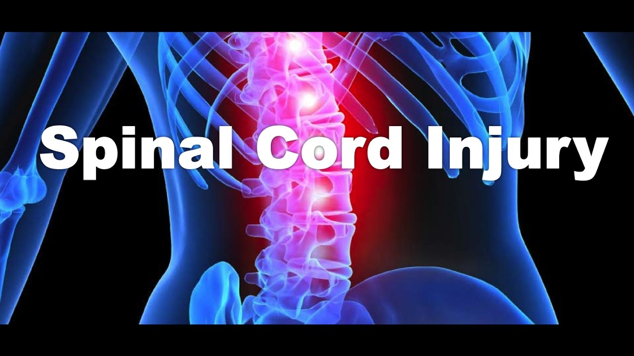 Spinal Cord Injuries (SCI) and Motor Vehicle Accidents