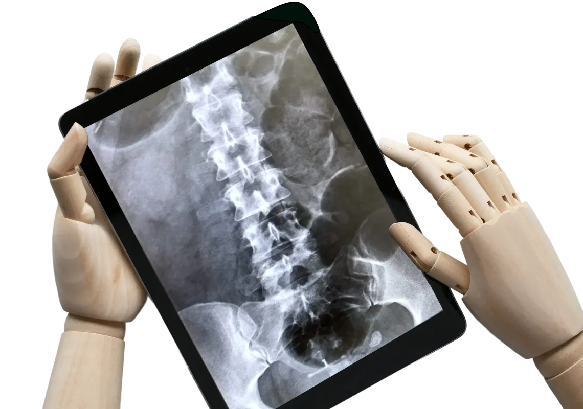 img why spinal cord injury cases are unique 2x