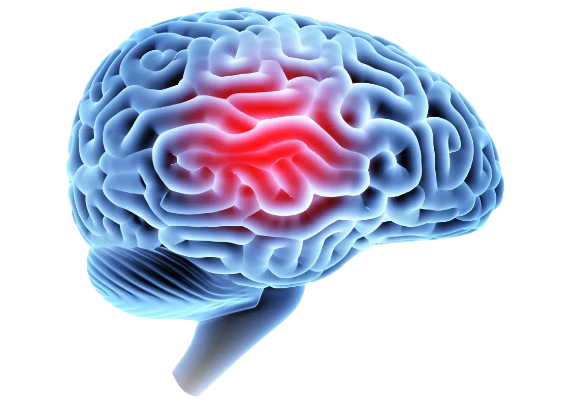 img why tbi cases are so complex 2x