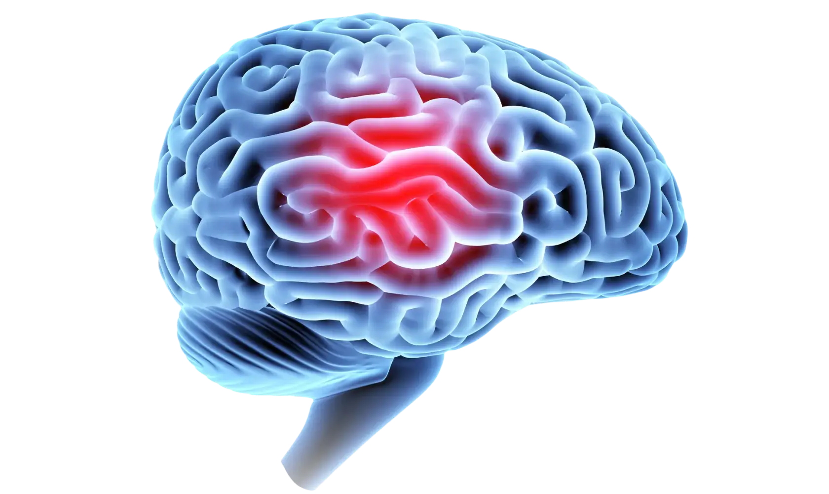 masthead traumatic brain injury 2x